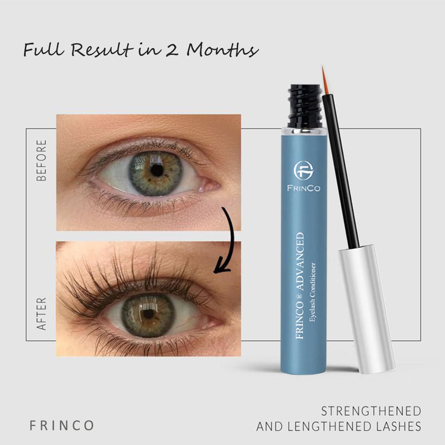 Eyelash Growth Serum — Fuller, Thicker Lashes & Brows in Weeks, 5ml - Health and wellness