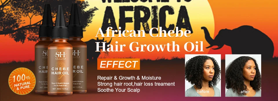 Chebe Hair Growth Serum & Powder — African Hair Loss Treatment Spray for Edges & Length