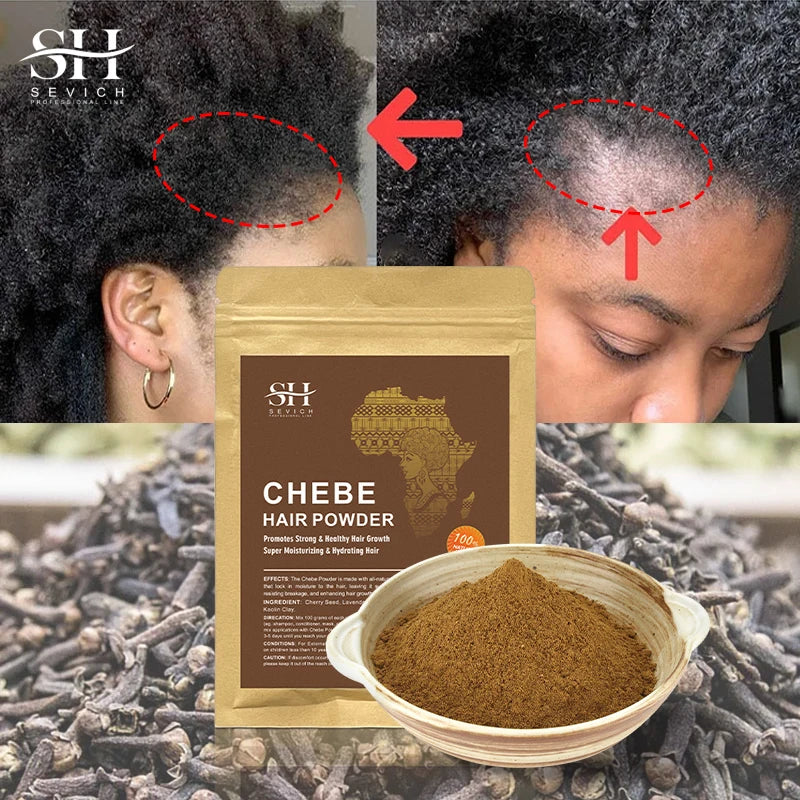 Chebe Hair Growth Serum & Powder — African Hair Loss Treatment Spray for Edges & Length