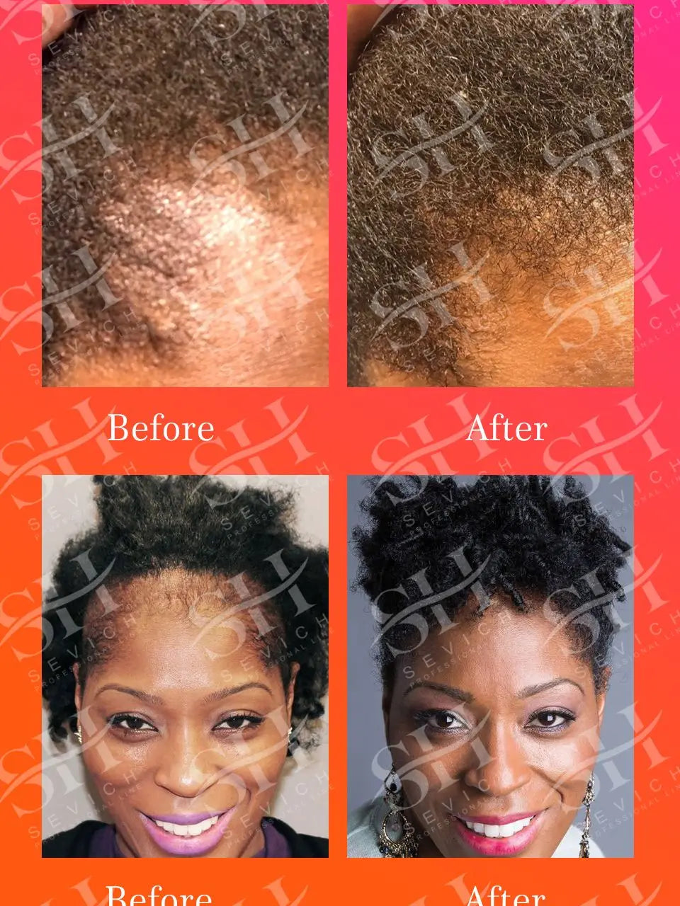 Chebe Hair Growth Serum & Powder — African Hair Loss Treatment Spray for Edges & Length