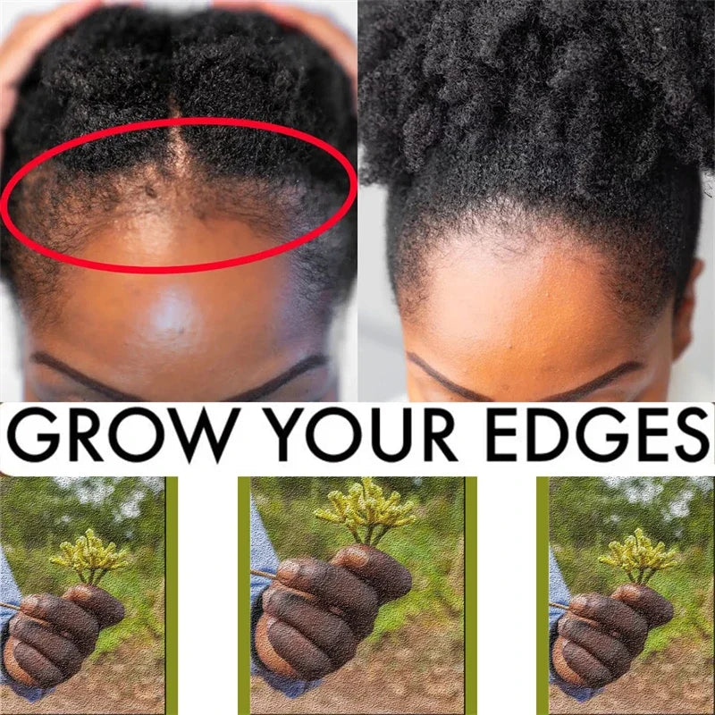 Chebe Hair Growth Shampoo — Ancient African Formula for Fast Hair Loss Treatment
