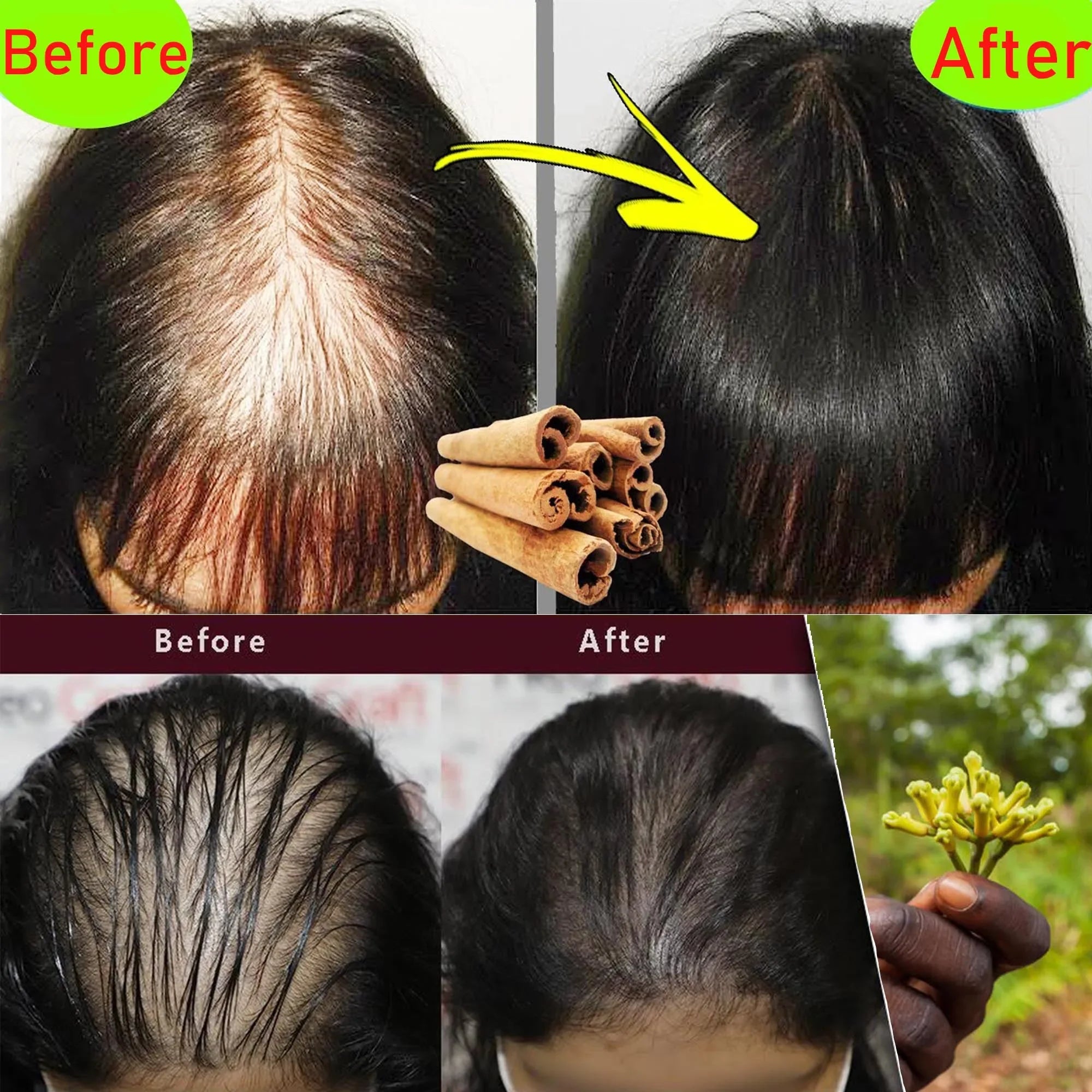 Chebe Hair Growth Shampoo — Ancient African Formula for Fast Hair Loss Treatment