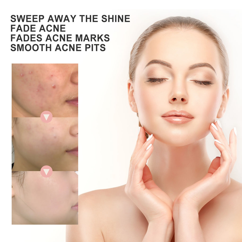 Acne Patch — Pore Cleansing, Blemish Repair & Moisturizing - Health and wellness